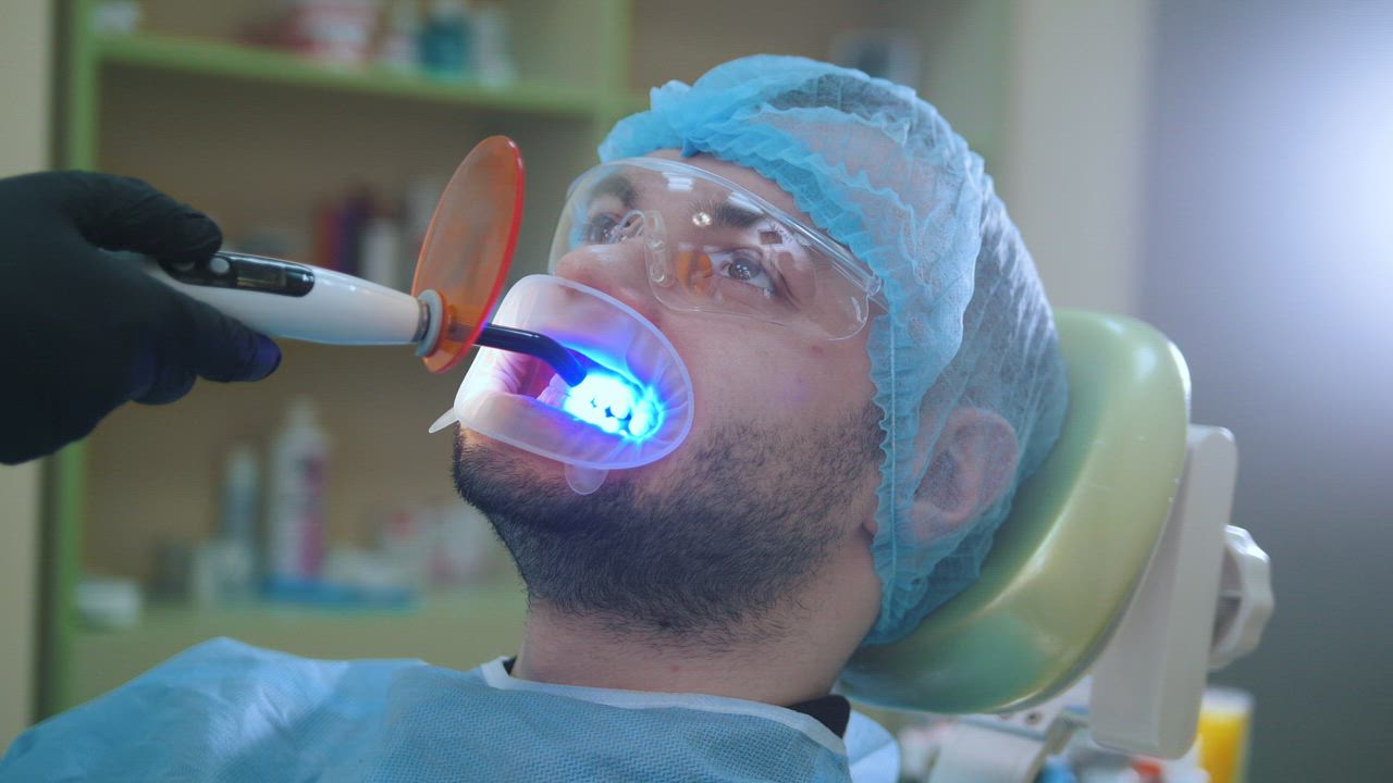 הלבנת שיניים